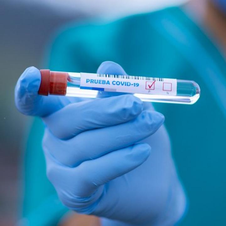 Coronavirus en Colombia: 73.572 casos y 30.459 recuperados 